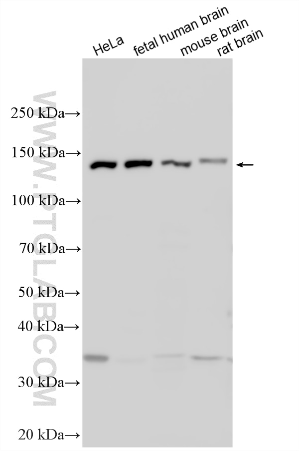 Western Blot (WB) analysis of various lysates using EFTUD1 Polyclonal antibody (24729-1-AP)