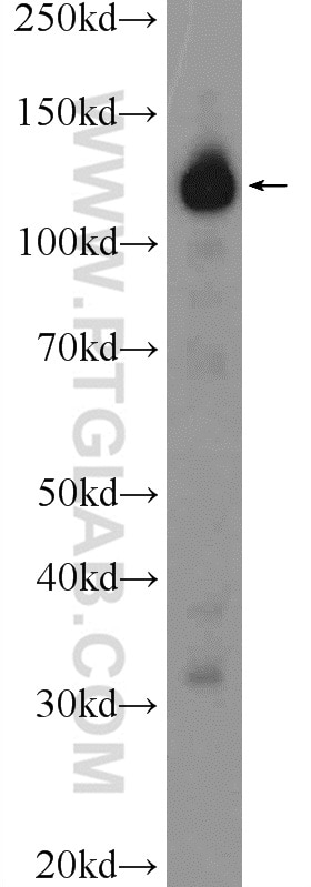 Western Blot (WB) analysis of fetal human brain tissue using EFTUD1 Polyclonal antibody (24729-1-AP)