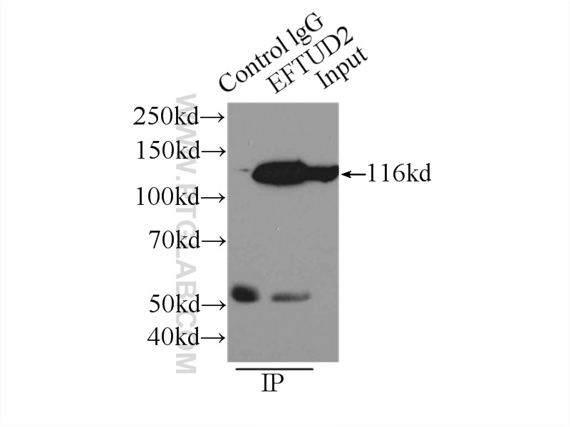 Immunoprecipitation (IP) experiment of HeLa cells using EFTUD2 Polyclonal antibody (10208-1-AP)