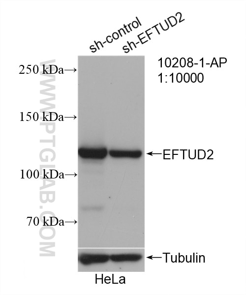 Western Blot (WB) analysis of HeLa cells using EFTUD2 Polyclonal antibody (10208-1-AP)