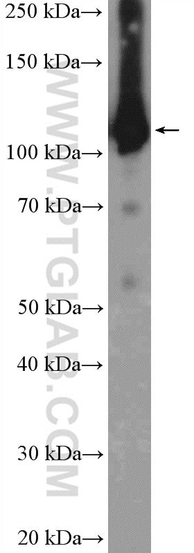 Western Blot (WB) analysis of HeLa cells using EFTUD2 Polyclonal antibody (10208-1-AP)