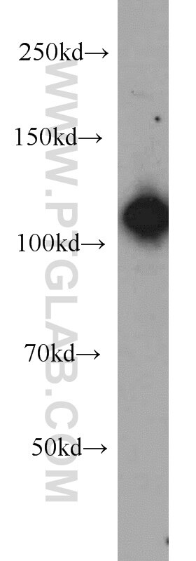 Western Blot (WB) analysis of HeLa cells using EFTUD2 Polyclonal antibody (10208-1-AP)