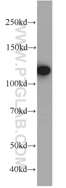 Western Blot (WB) analysis of HeLa cells using EFTUD2 Polyclonal antibody (10208-1-AP)