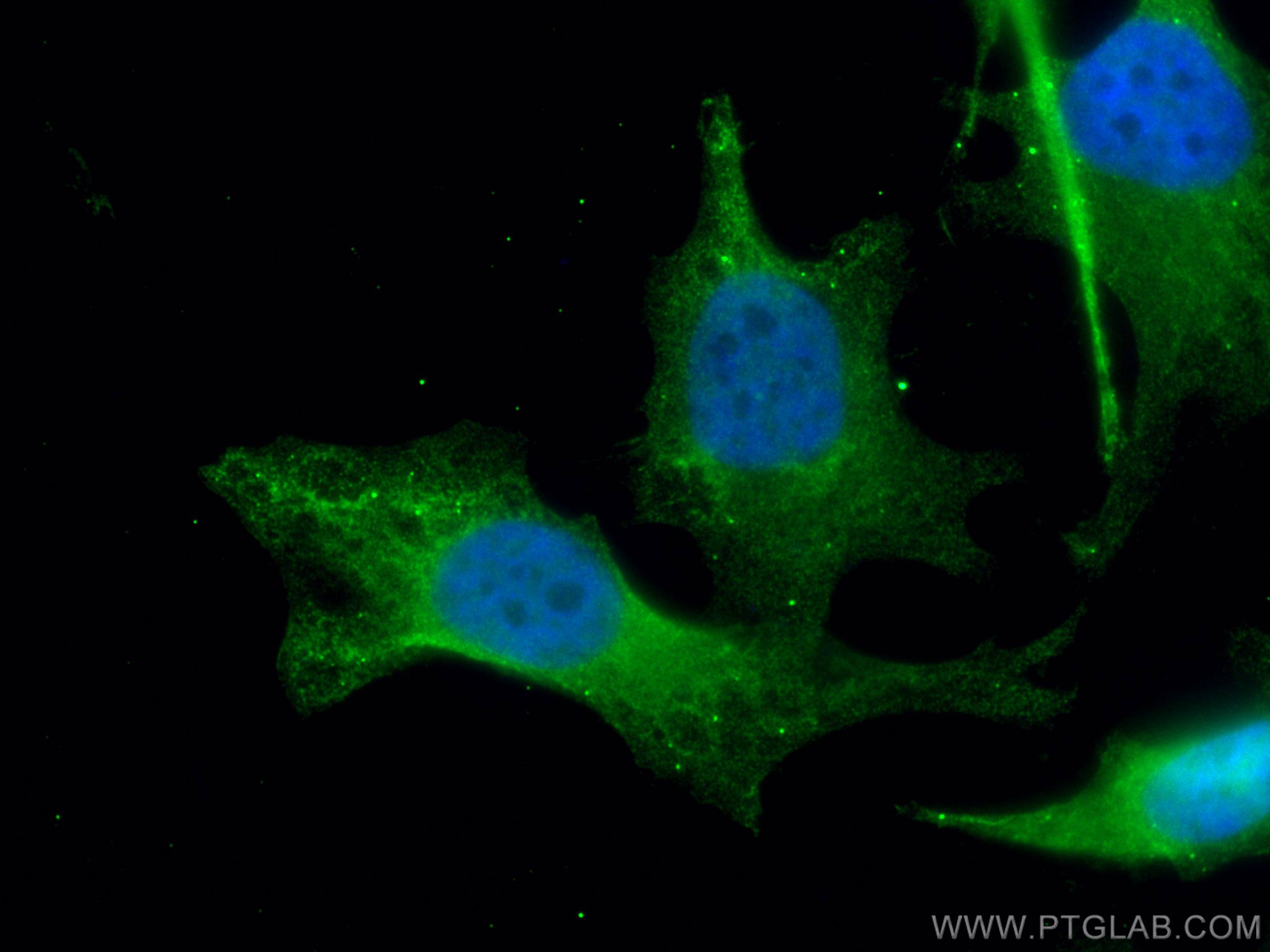 Immunofluorescence (IF) / fluorescent staining of HeLa cells using EFTUD2 Monoclonal antibody (67855-1-Ig)