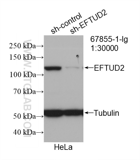 Western Blot (WB) analysis of HeLa cells using EFTUD2 Monoclonal antibody (67855-1-Ig)