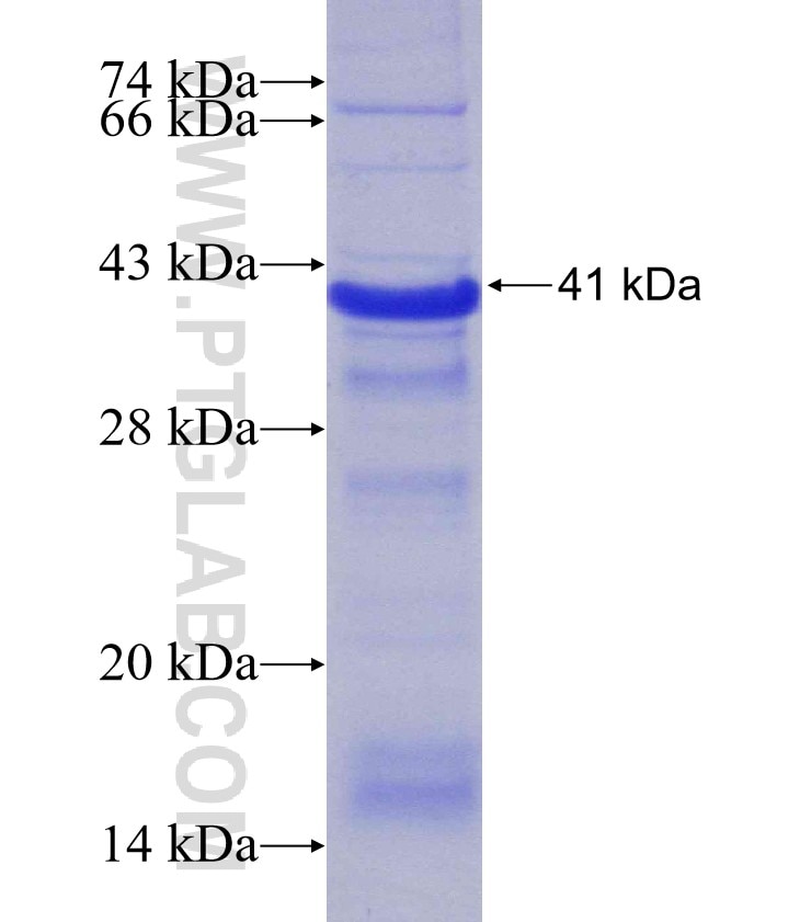 EFTUD2 fusion protein Ag24345 SDS-PAGE