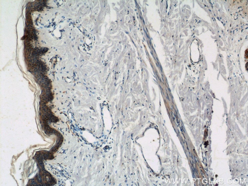 IHC staining of human skin using 22209-1-AP