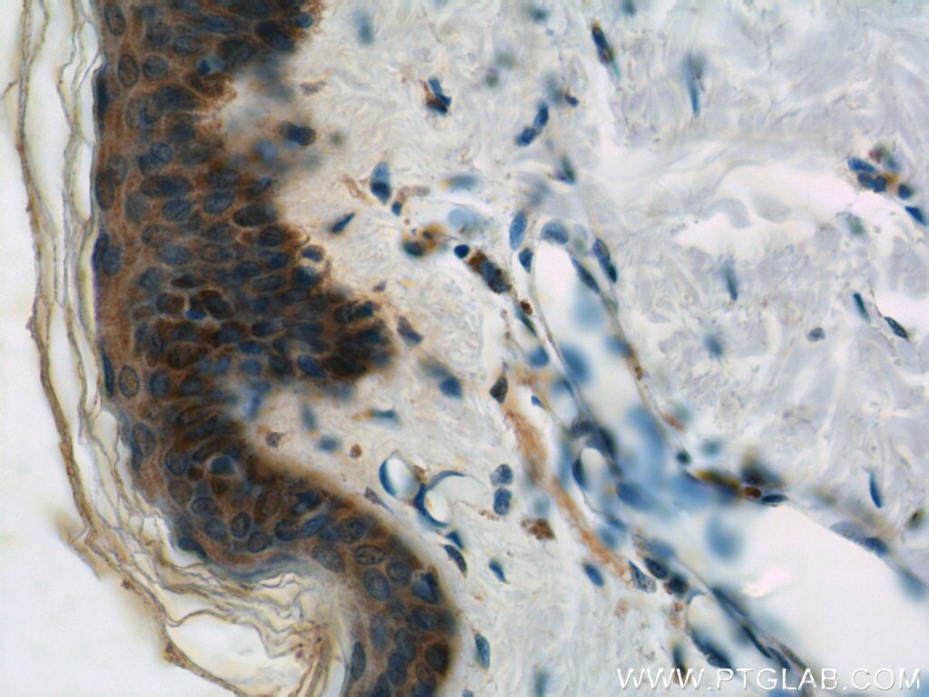 Immunohistochemistry (IHC) staining of human skin tissue using EGF Polyclonal antibody (22209-1-AP)