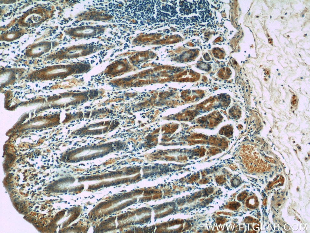 Immunohistochemistry (IHC) staining of human stomach tissue using EGF Polyclonal antibody (22209-1-AP)