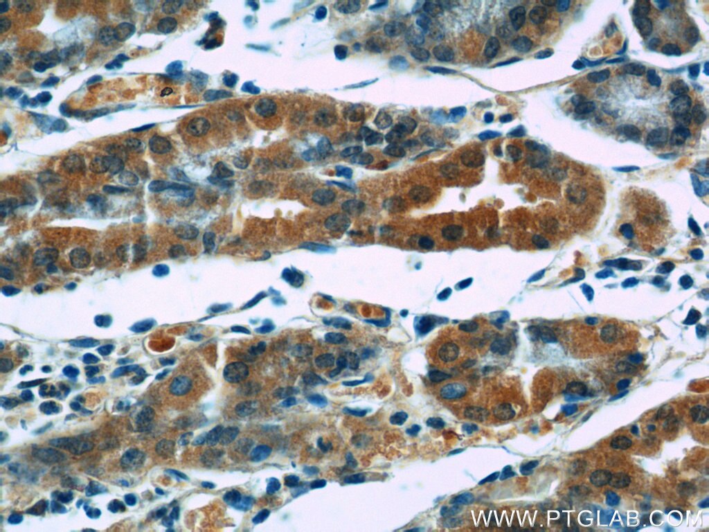 Immunohistochemistry (IHC) staining of human stomach tissue using EGF Polyclonal antibody (22209-1-AP)