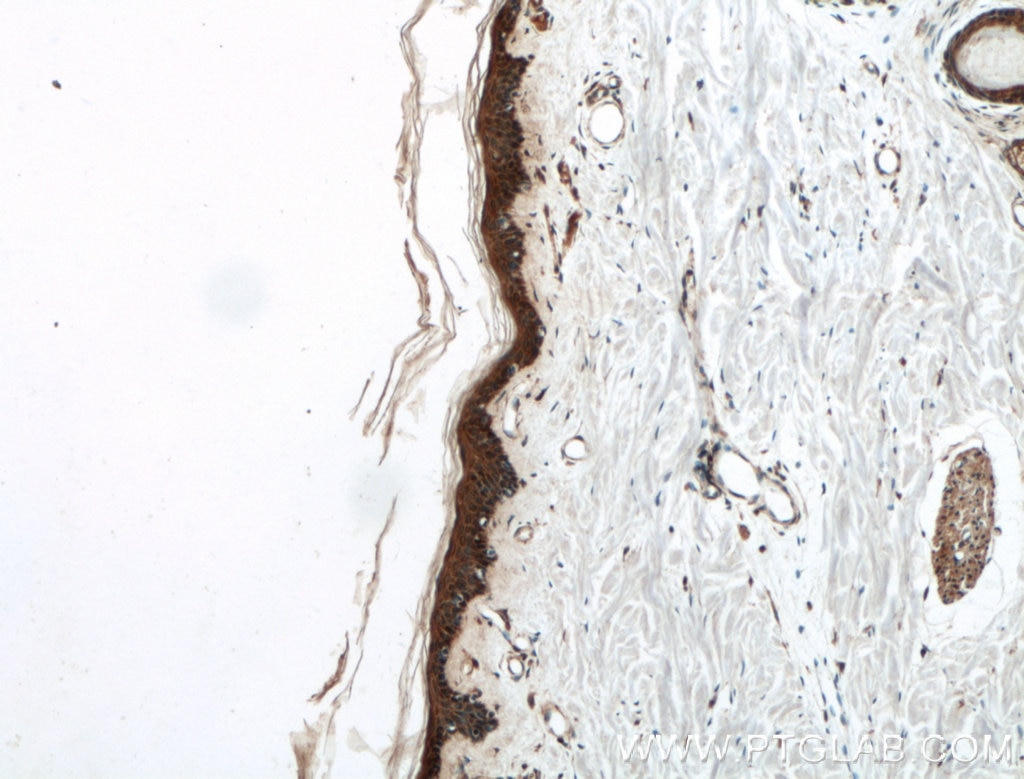 Immunohistochemistry (IHC) staining of human skin tissue using EGF Polyclonal antibody (27141-1-AP)