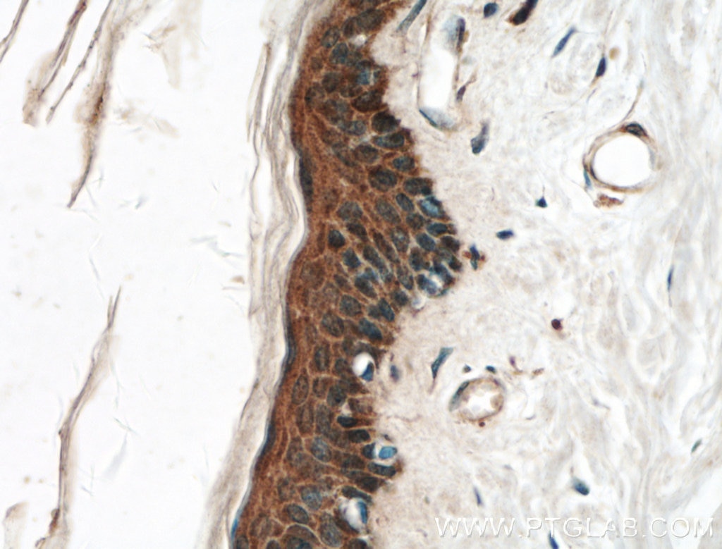Immunohistochemistry (IHC) staining of human skin tissue using EGF Polyclonal antibody (27141-1-AP)