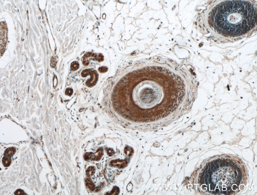 IHC staining of human skin using 27141-1-AP