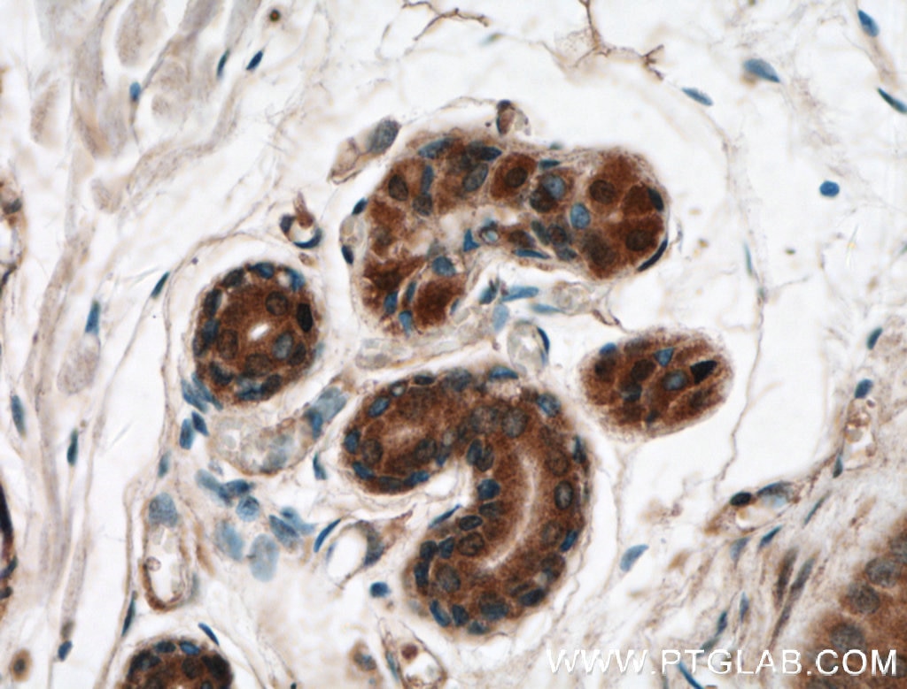 Immunohistochemistry (IHC) staining of human skin tissue using EGF Polyclonal antibody (27141-1-AP)