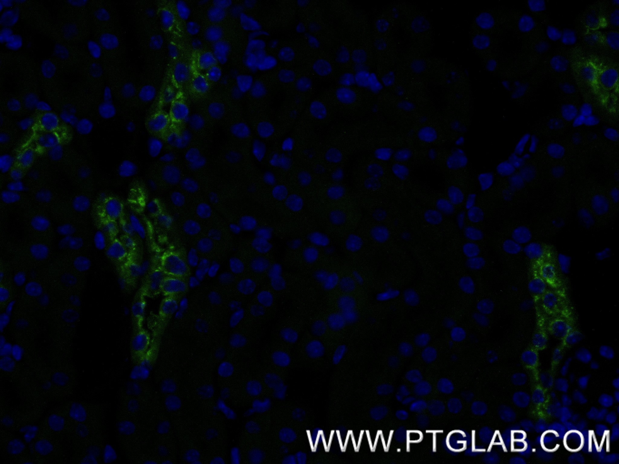 Immunofluorescence (IF) / fluorescent staining of mouse kidney tissue using EGF Recombinant antibody (84601-1-RR)
