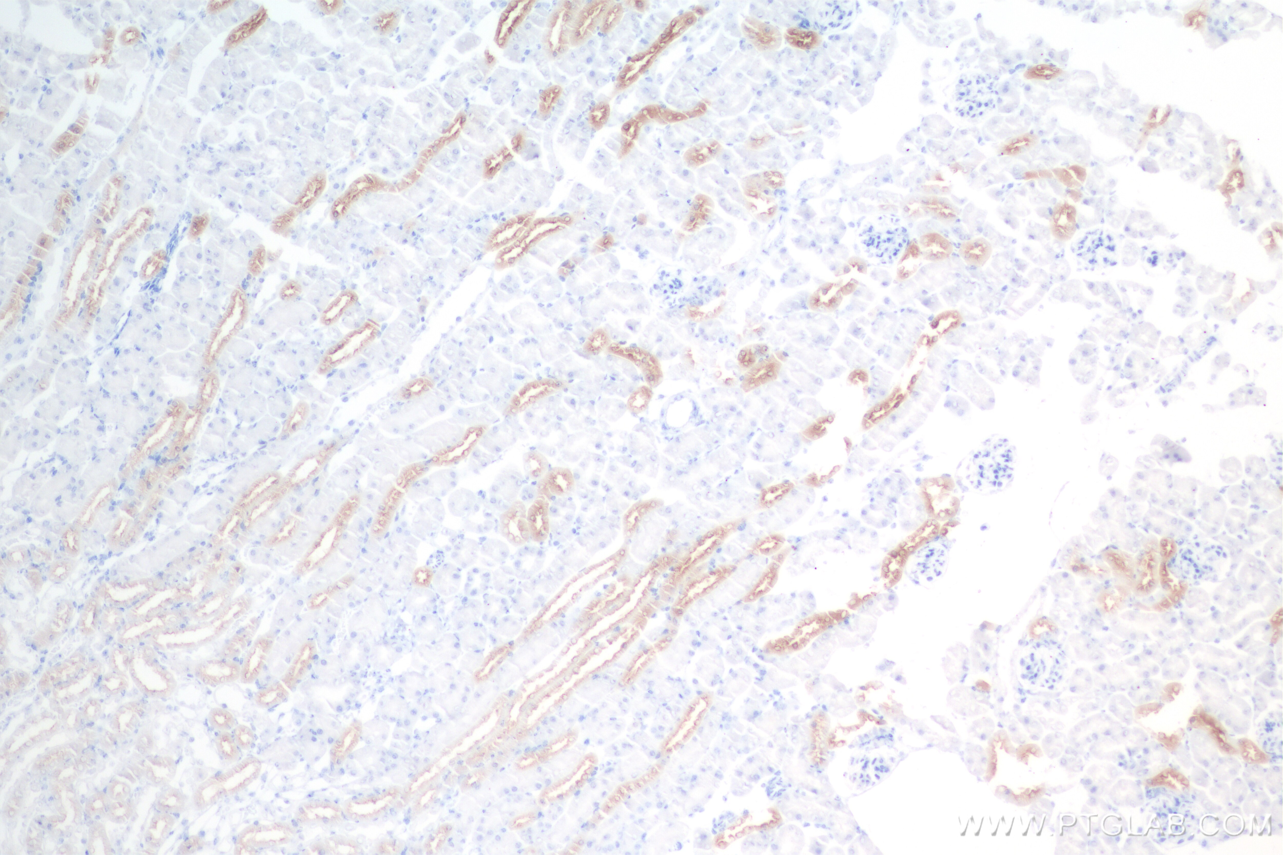 Immunohistochemistry (IHC) staining of mouse kidney tissue using EGF Recombinant antibody (84601-1-RR)