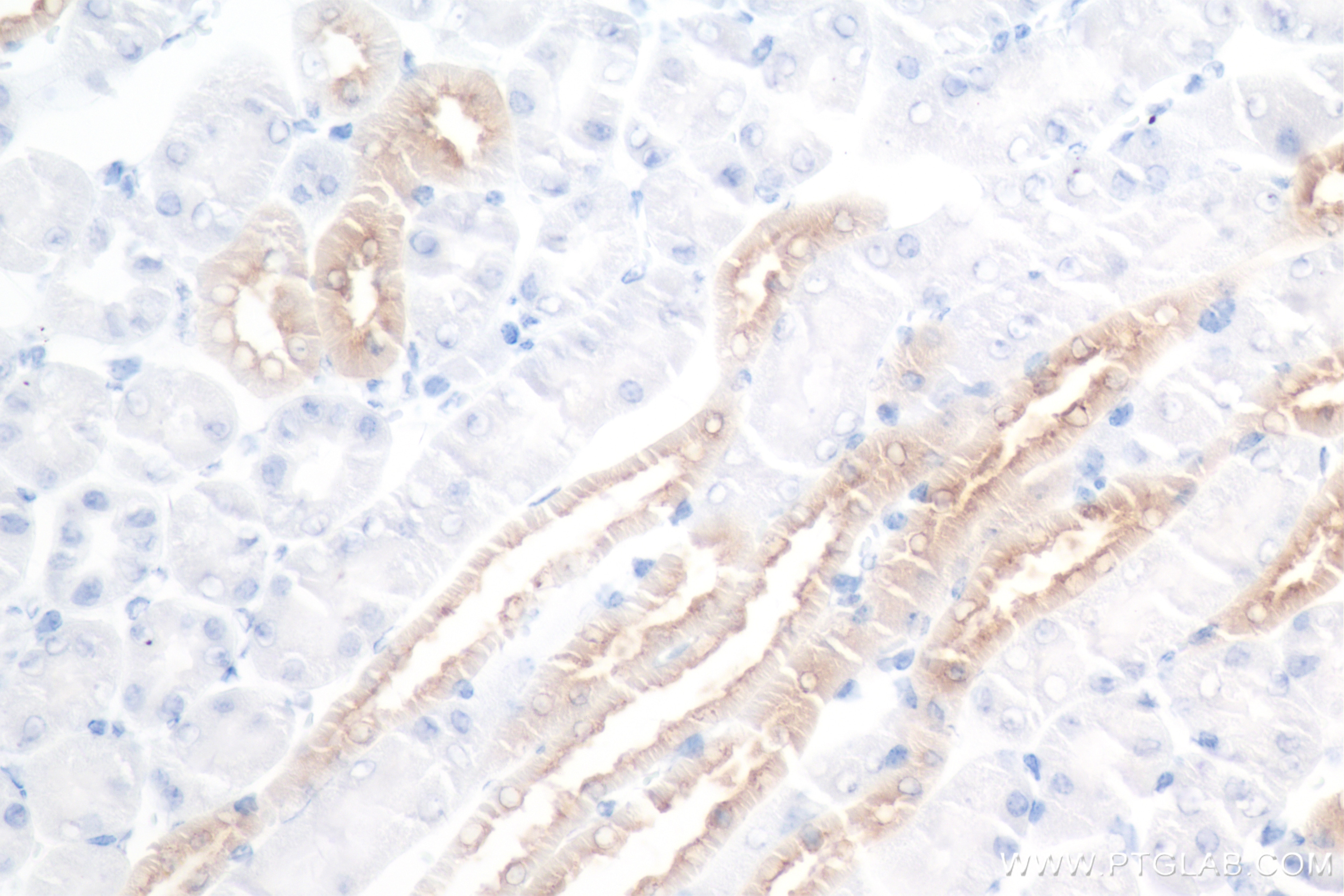 Immunohistochemistry (IHC) staining of mouse kidney tissue using EGF Recombinant antibody (84601-1-RR)