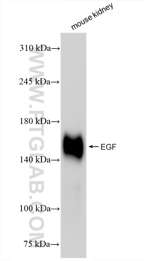 Western Blot (WB) analysis of mouse kidney tissue using EGF Recombinant antibody (84601-1-RR)