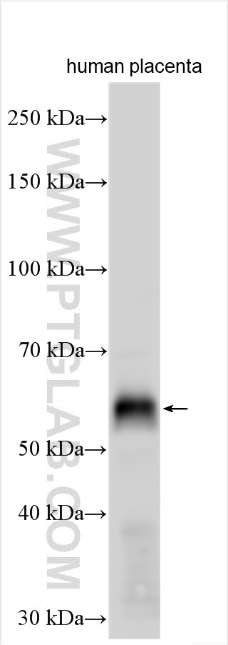 Western Blot (WB) analysis of various lysates using EGFL6 Polyclonal antibody (24748-1-AP)