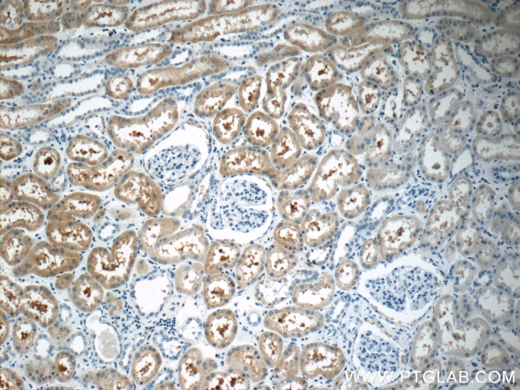 Immunohistochemistry (IHC) staining of human kidney tissue using EGFL7 Polyclonal antibody (19291-1-AP)