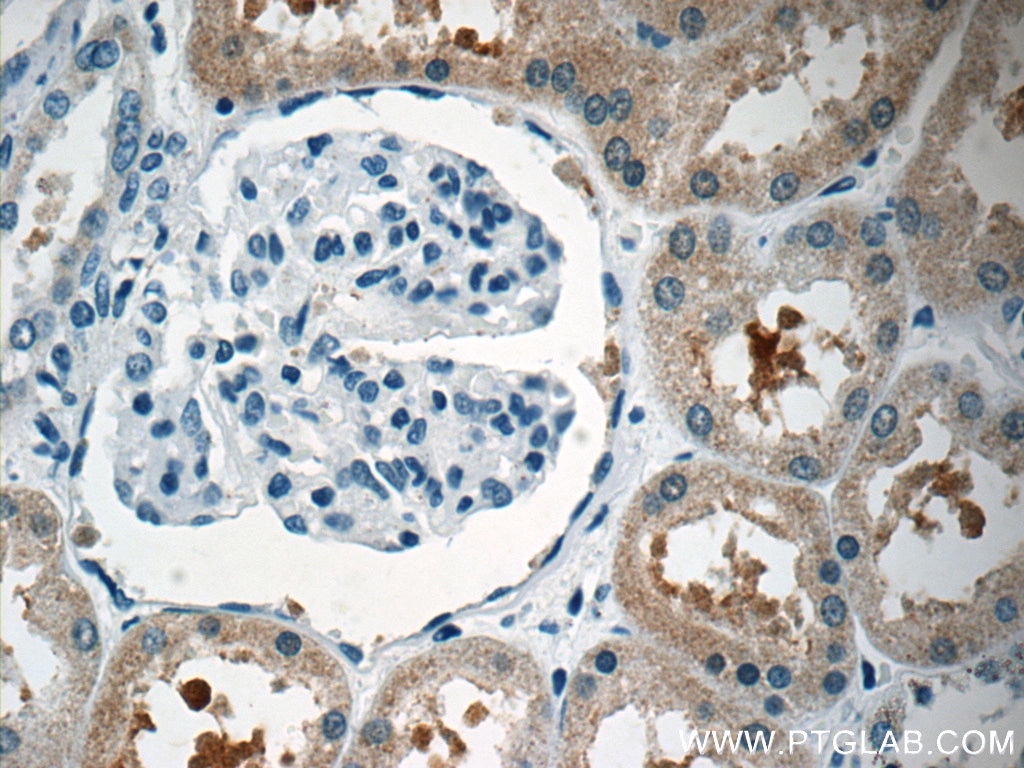 Immunohistochemistry (IHC) staining of human kidney tissue using EGFL7 Polyclonal antibody (19291-1-AP)