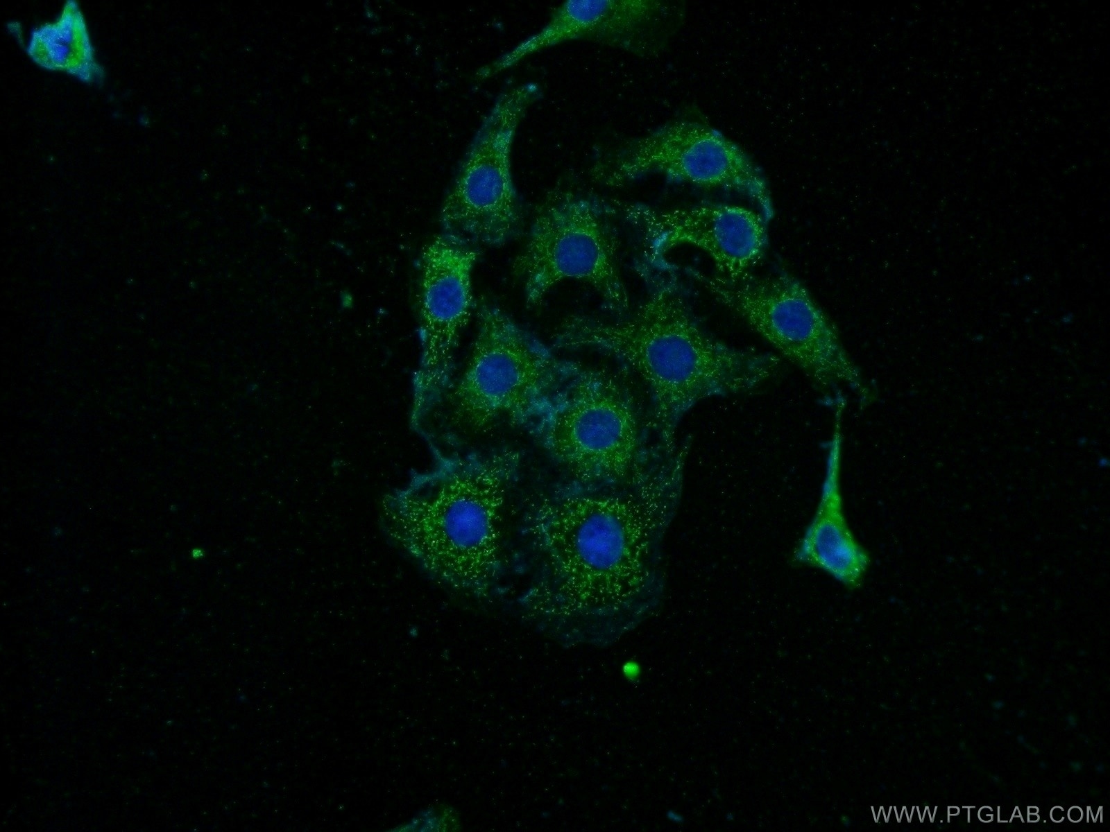 Immunofluorescence (IF) / fluorescent staining of SH-SY5Y cells using Pikachurin Polyclonal antibody (14578-1-AP)