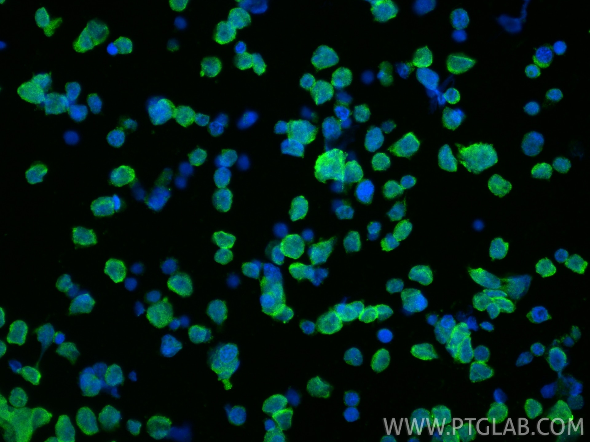 Immunofluorescence (IF) / fluorescent staining of Y79 cells using Pikachurin Polyclonal antibody (14578-1-AP)