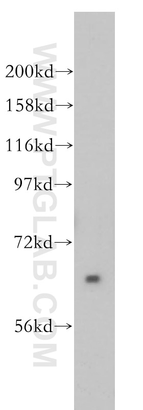 Western Blot (WB) analysis of SH-SY5Y cells using Pikachurin Polyclonal antibody (14578-1-AP)