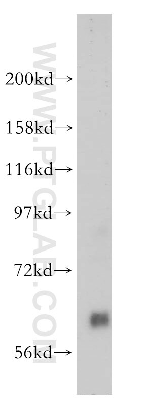 Western Blot (WB) analysis of human placenta tissue using Pikachurin Polyclonal antibody (14578-1-AP)