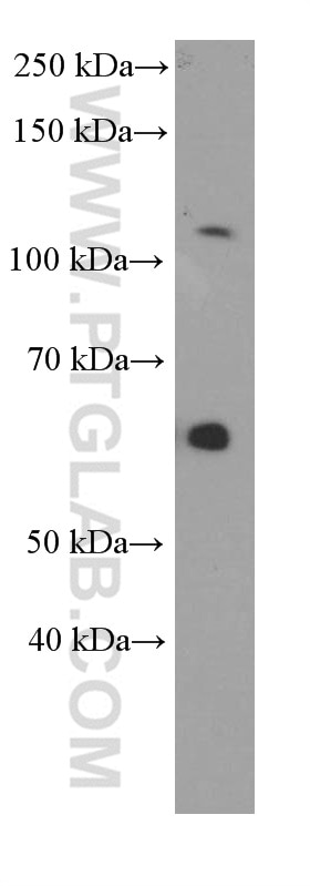 WB analysis of PC-3 using 66232-1-Ig