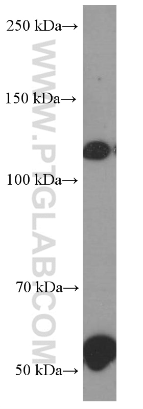 Western Blot (WB) analysis of human retina tissue using Pikachurin Monoclonal antibody (66232-1-Ig)