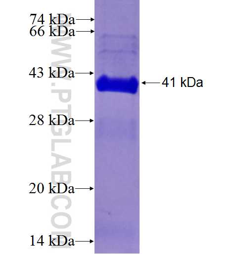 EGFLAM fusion protein Ag5986 SDS-PAGE