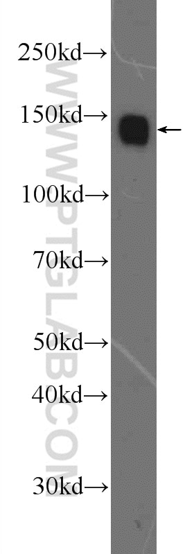 EGFR (N-terminal) Polyclonal antibody