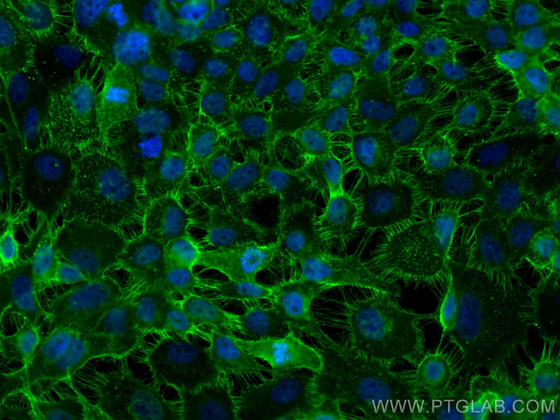 Immunofluorescence (IF) / fluorescent staining of A431 cells using EGFR Polyclonal antibody (30139-1-AP)