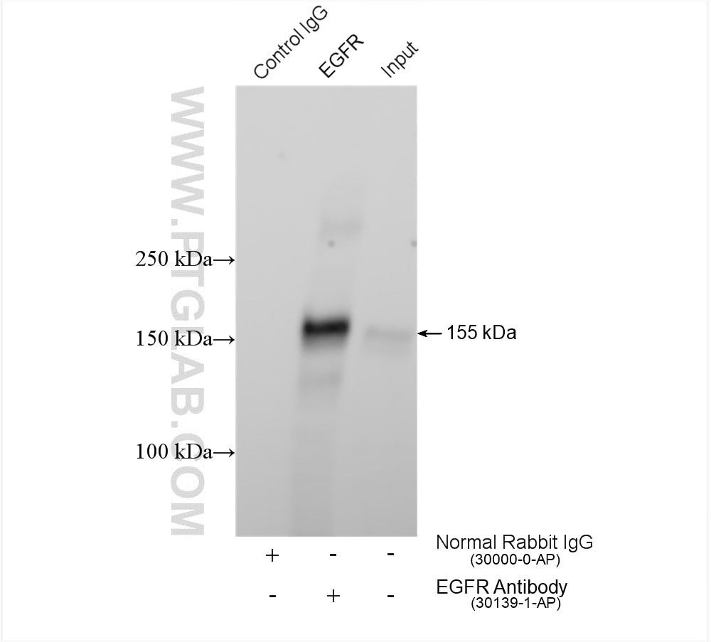 Immunoprecipitation (IP) experiment of HeLa cells using EGFR Polyclonal antibody (30139-1-AP)