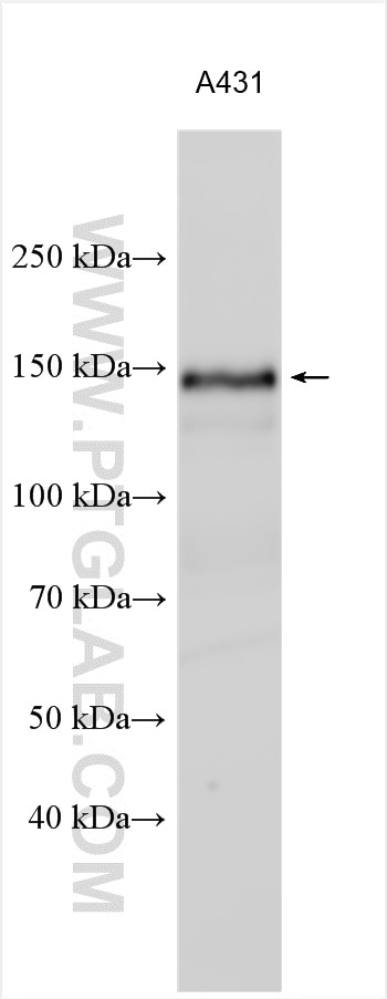 Western Blot (WB) analysis of A431 cells using EGFR Polyclonal antibody (30139-1-AP)