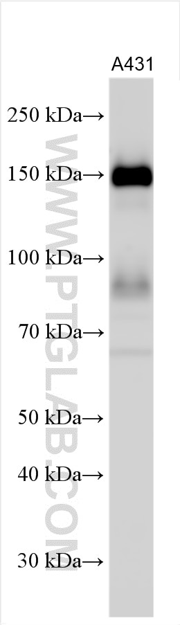 Western Blot (WB) analysis of various lysates using EGFR Polyclonal antibody (30139-1-AP)