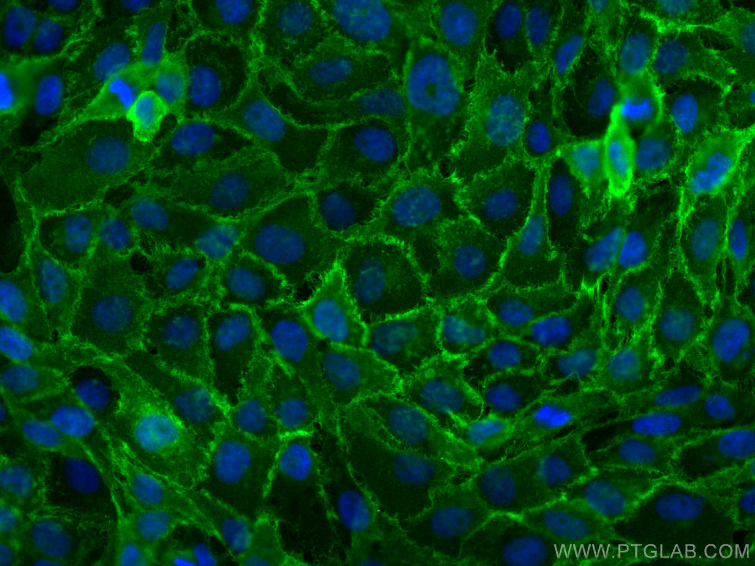 Immunofluorescence (IF) / fluorescent staining of A431 cells using EGFR (C-terminal) Polyclonal antibody (51071-2-AP)