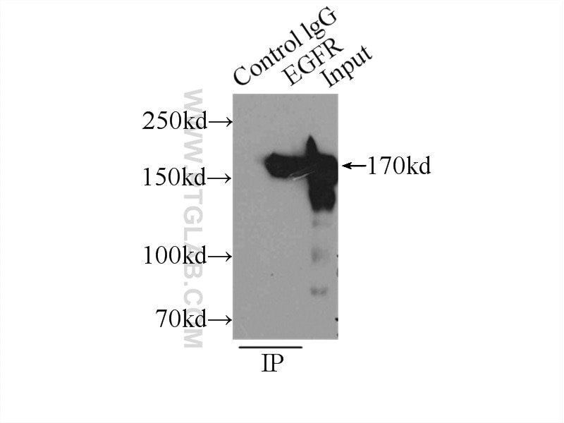Immunoprecipitation (IP) experiment of A431 cells using EGFR (C-terminal) Polyclonal antibody (51071-2-AP)