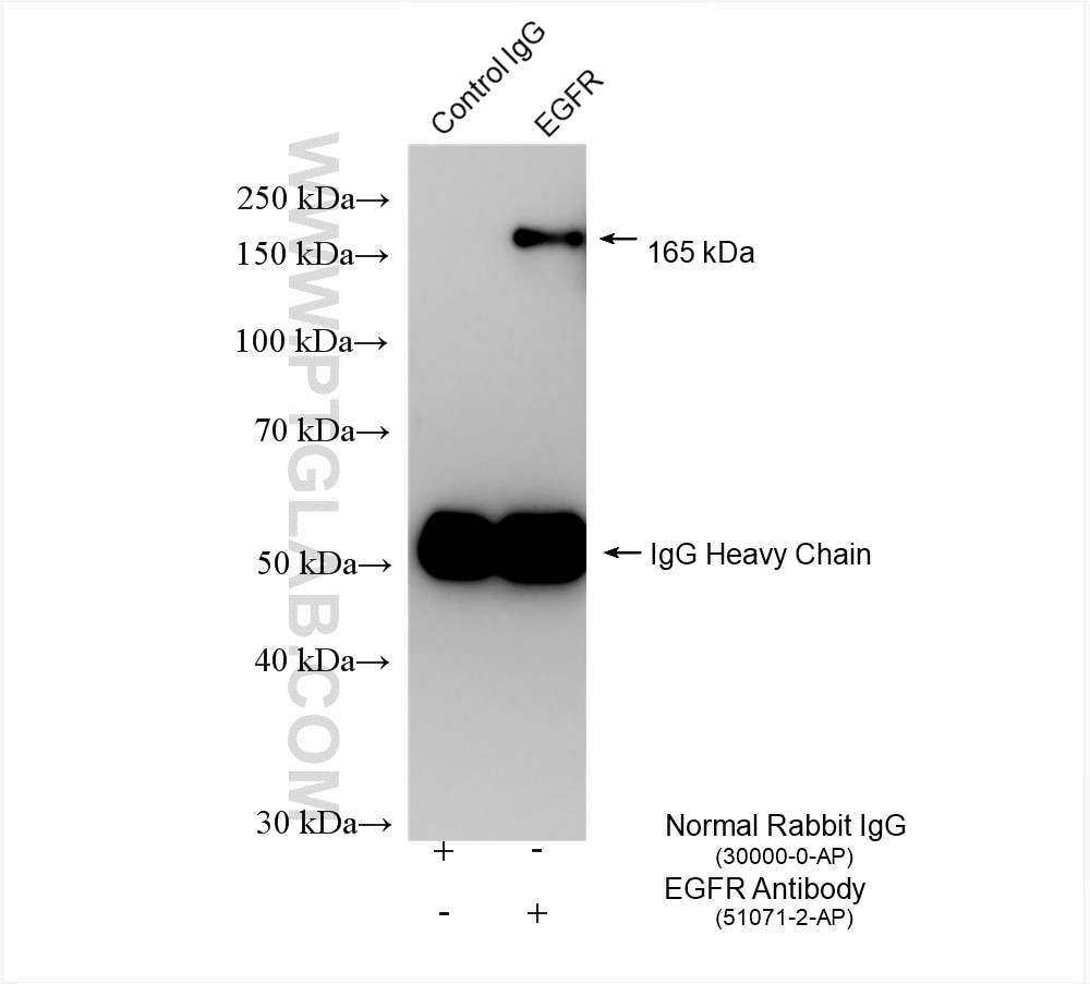 Immunoprecipitation (IP) experiment of A431 cells using EGFR (C-terminal) Polyclonal antibody (51071-2-AP)