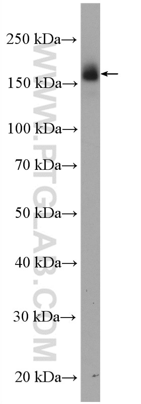 Western Blot (WB) analysis of A431 cells using EGFR (C-terminal) Polyclonal antibody (51071-2-AP)