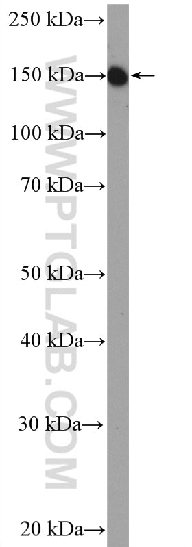 Western Blot (WB) analysis of L02 cells using EGFR (C-terminal) Polyclonal antibody (51071-2-AP)