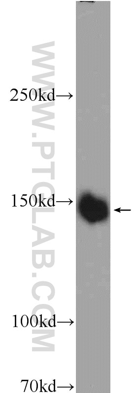 Western Blot (WB) analysis of HeLa cells using EGFR (C-terminal) Polyclonal antibody (51071-2-AP)