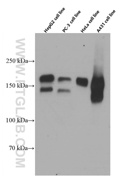 Western Blot (WB) analysis of various lysates using EGFR Monoclonal antibody (66455-1-Ig)