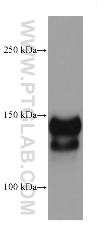 Western Blot (WB) analysis of A431 cells using EGFR Monoclonal antibody (66455-1-Ig)