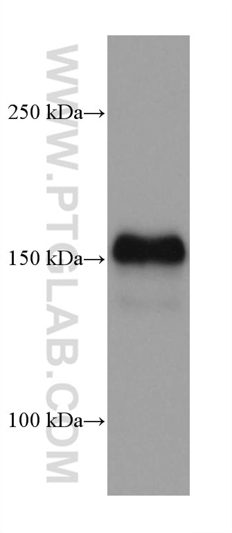 Western Blot (WB) analysis of HepG2 cells using EGFR Monoclonal antibody (66455-1-Ig)