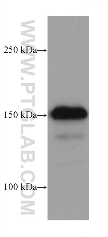 Western Blot (WB) analysis of PC-3 cells using EGFR Monoclonal antibody (66455-1-Ig)