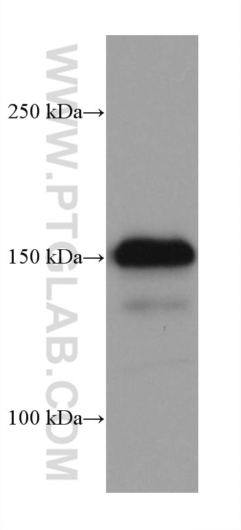WB analysis of PC-3 using 66455-1-Ig