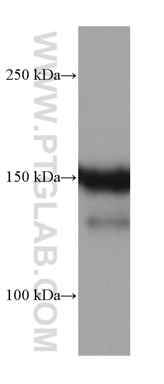 Western Blot (WB) analysis of LNCaP cells using EGFR Monoclonal antibody (66455-1-Ig)