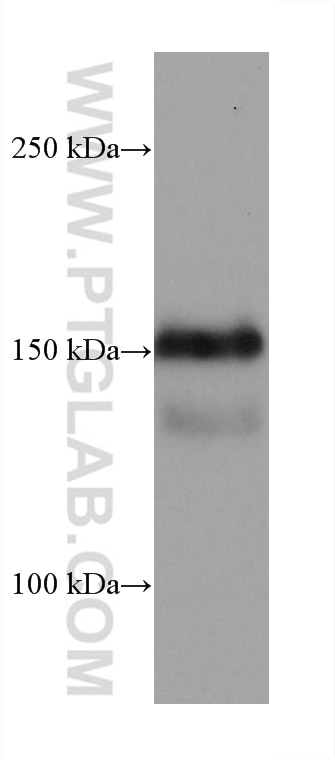 Western Blot (WB) analysis of SKOV-3 cells using EGFR Monoclonal antibody (66455-1-Ig)
